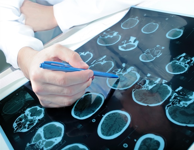 aggression behavior in men with CTE